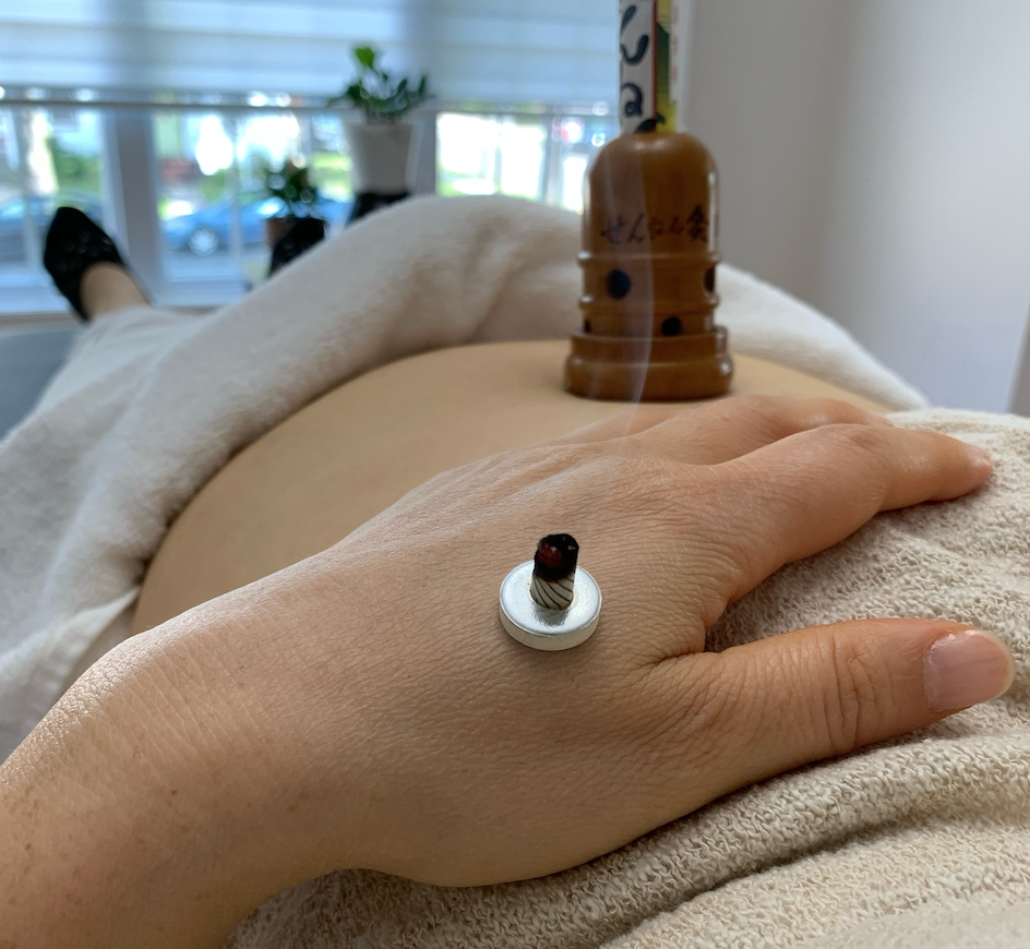 Moxibustion therapy detail.